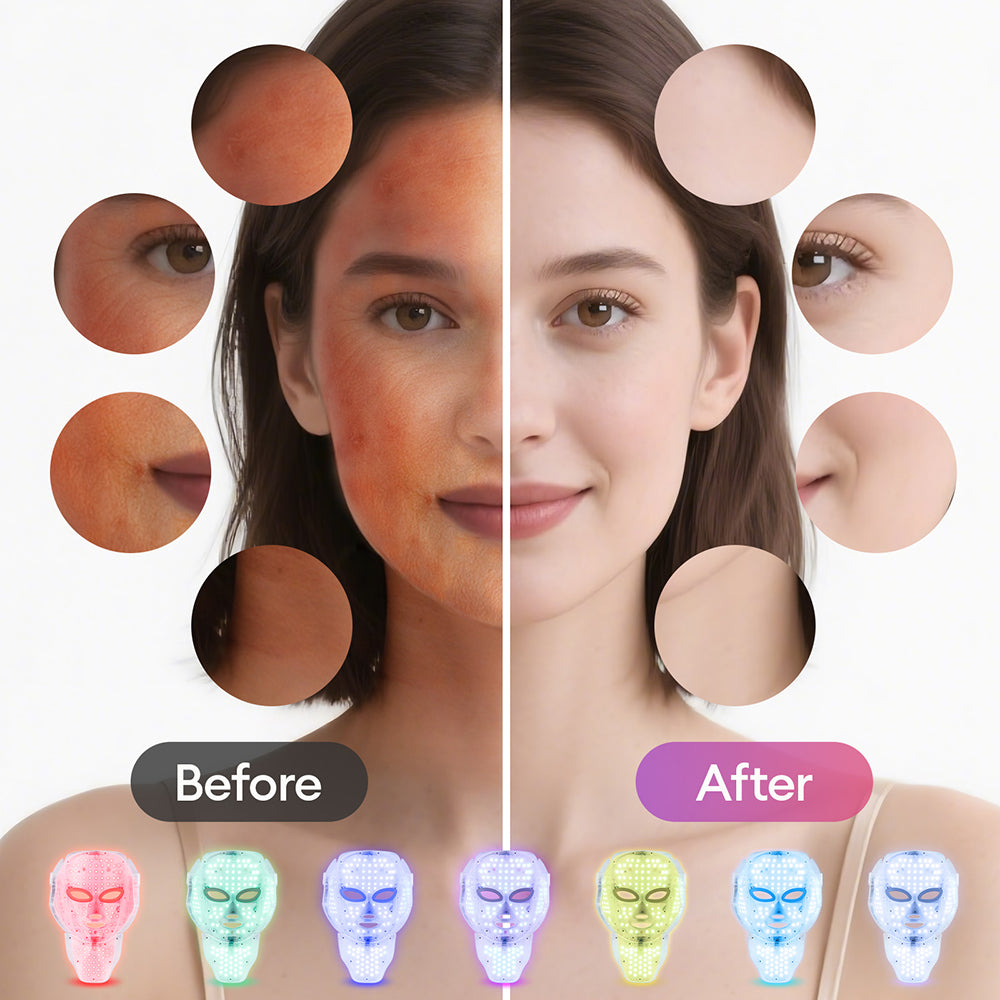 LED Face & Neck Mask – Skin Tightening & Repair